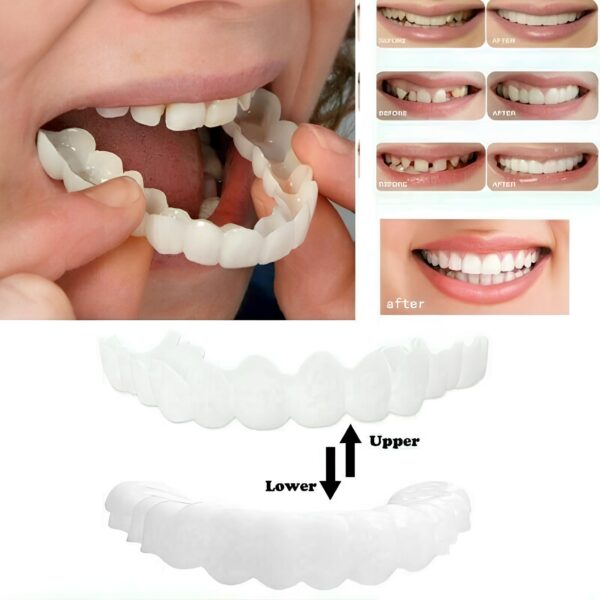 Zdejmowane licówki do zębów Snap On Smile zestaw góra i dół - obrazek 2
